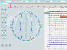 Clinical EEG Software | StratusEEG