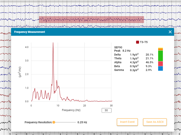 Stratus EEG software frequency analysis tool